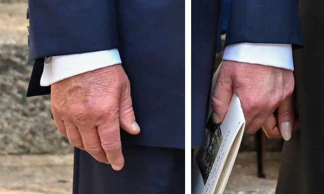 makeup on both of Trump's hands in July 2022