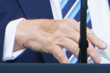 Trump wearing a couple of band-aids on October 10, 2020