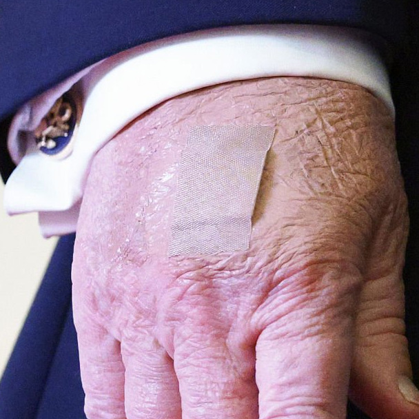 Trump sports a band-aid on his right hand over the made-up area.