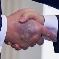 The bruise on Trump's right hand is very visible in the absence of makeup (Aug 25, 2025).