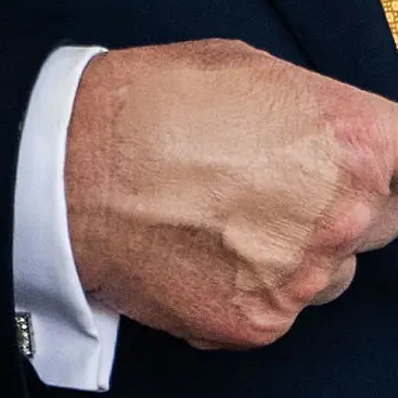 Visible cover-up makeup on Trump's right hand (July 22, 2025).